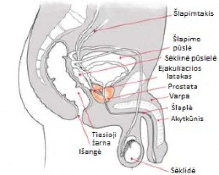 implantai į varpą vangus erekcija kaip gydyti